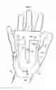 Fig. 07 - Grip assist apparatus with insert