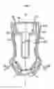 Fig. 08 - Grip assist apparatus with insert