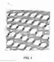 Fig. 02 - ARTICLE OF FOOTWEAR WITH BRAIDED UPPER