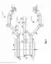 Fig. 04 - Medical robotic system with image referenced camera control using partitionable orientational and translational modes