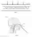 Fig. 02 - Catheter with optical sensing