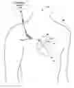 Fig. 01 - Medical device including feedthrough assembly