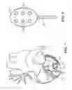 Fig. 05 - Highly flexible mapping and treatment device