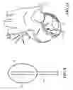 Fig. 06 - Highly flexible mapping and treatment device