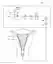 Fig. 01 - Systems and methods for evaluating the integrity of a uterine cavity