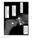 Fig. 07 - Quantified injury diagnostics