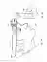 Fig. 09 - Vein imager with a dual buffer mode of operation