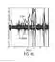Fig. 16 - Meal detection devices and methods