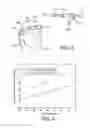 Fig. 03 - Gear for holding a physiological sensor