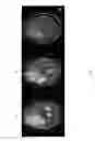 Fig. 06 - Topological evolution of tumor imagery