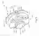 Fig. 06 - MRI biopsy sample