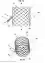 Fig. 02 - Systems, Apparatuses, and Methods for Vessel Crossing and Closure