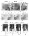 Fig. 09 - Systems, Apparatuses, and Methods for Vessel Crossing and Closure
