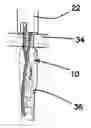 Fig. 01 - All-suture suture anchor systems and methods