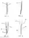 Fig. 02 - All-suture suture anchor systems and methods