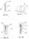 Fig. 08 - All-suture suture anchor systems and methods