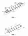 Fig. 04 - Buttress attachment features for surgical stapling apparatus