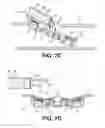 Fig. 09 - Elongated tissue compression device system with smooth outer contour and orthogonal curved aligning surfaces