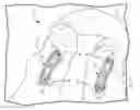 Fig. 01 - Battery powered electromagnetic tissue compression device