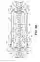Fig. 13 - Battery powered electromagnetic tissue compression device