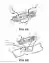 Fig. 07 - Tissue compression device with features to contain needles and suture during packaging and placement in body