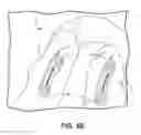 Fig. 09 - Tissue compression device with features to contain needles and suture during packaging and placement in body