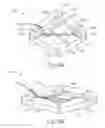 Fig. 08 - Tissue compression assemblies with biodegradable interlinks