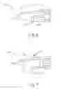 Fig. 06 - Non-magnetic fragmentable tissue compression devices