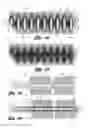 Fig. 02 - Occluding device and method of manufacturing occluding devices