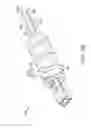 Fig. 12 - Unfocused electrohydraulic lithotripter