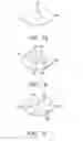 Fig. 15 - Unfocused electrohydraulic lithotripter