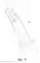 Fig. 11 - Mechanisms for controlling rotation of outer cannula for use in endoscopic tool