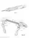 Fig. 08 - Spinal trauma correction and fixation