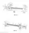Fig. 09 - Spinal trauma correction and fixation