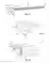 Fig. 10 - Spinal trauma correction and fixation