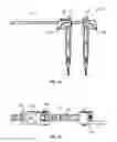 Fig. 17 - Spinal trauma correction and fixation