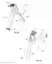 Fig. 26 - Spinal trauma correction and fixation