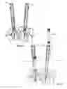 Fig. 28 - Spinal trauma correction and fixation