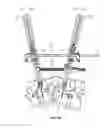 Fig. 33 - Spinal trauma correction and fixation