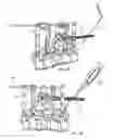 Fig. 40 - Spinal trauma correction and fixation