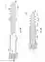 Fig. 08 - Porous fixation devices and methods