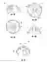 Fig. 06 - SURGICAL TRAYS, INSTRUMENTS AND METHODS FOR IMPLANTING A HIP REPLACEMENT PROSTHESIS