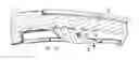 Fig. 01 - Adjustable segmental distalization appliance for orthodontic treatments