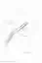 Fig. 24 - Helicoil Interference Fixation System For Attaching a Graft Ligament to a Bone