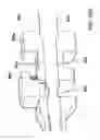 Fig. 22 - Intervertebral spacer and plate