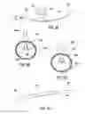 Fig. 07 - Retracting or/and supporting periurethral tissue