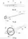 Fig. 09 - Retracting or/and supporting periurethral tissue
