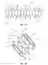 Fig. 02 - Short stent
