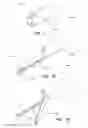 Fig. 04 - Short stent