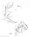 Fig. 02 - Dynamic exoskeletal orthosis